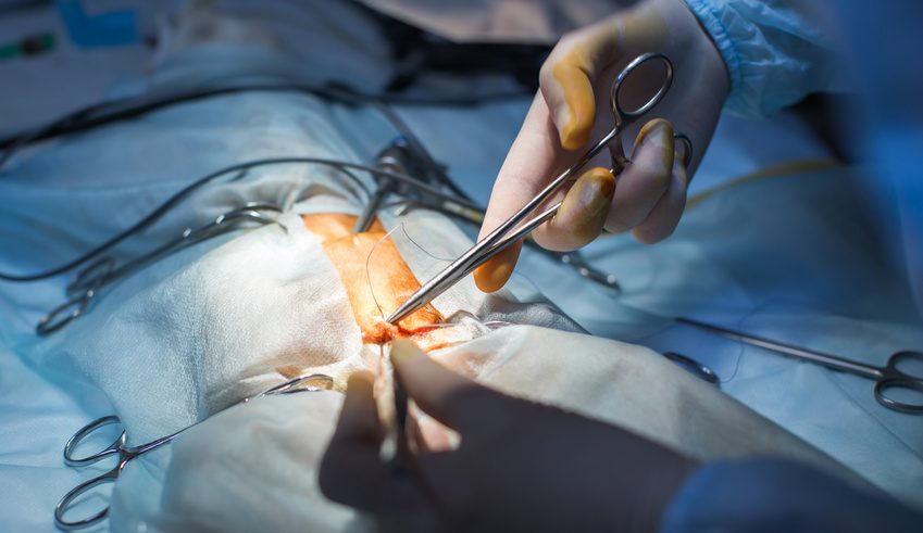 Erfahrungsbericht sterilisation frau Vasektomie/ Sterilisation